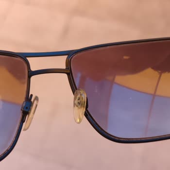 Gözlük Camı Deformasyonu Ve Yedek Parça Eksikliği Hayal Kırıklığı Yarattı