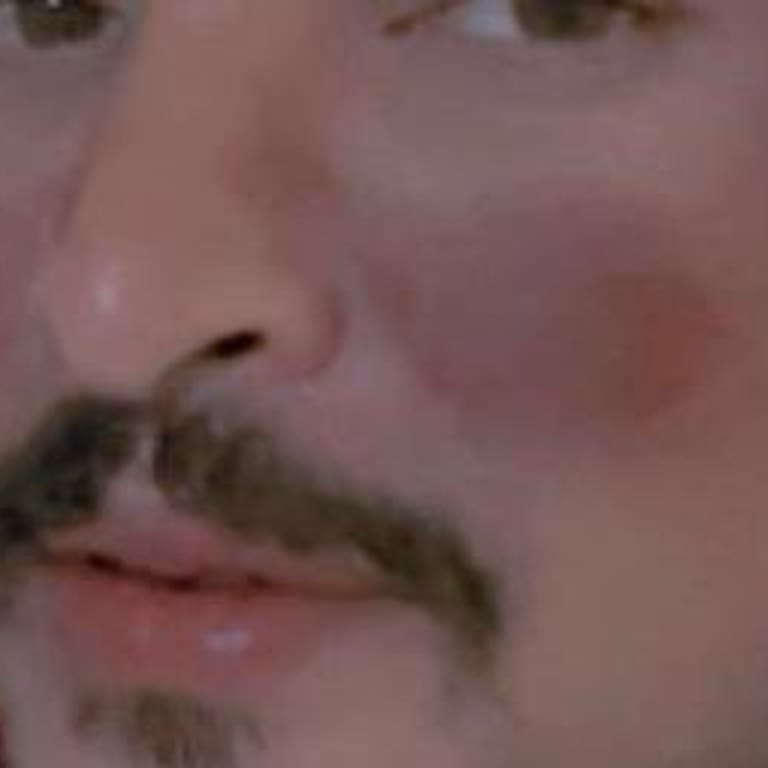 Yanlış Uygulama Sonucu Cilt Lekesi Oluştu