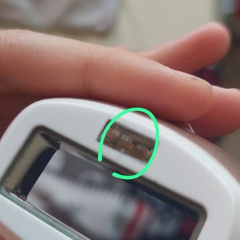 Philips Lumea Lazer Başlıkları Kısa Sürede Çatladı, Garanti Kapsamı Belirsiz