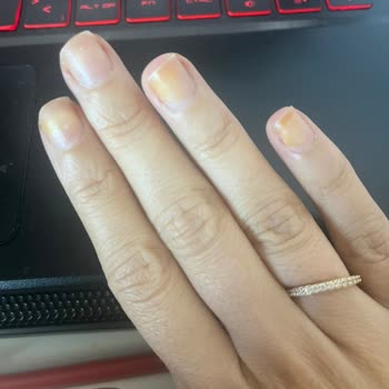 Flormar Oje Tırnaklarımı Sararttı, Bir Daha Asla Almam!