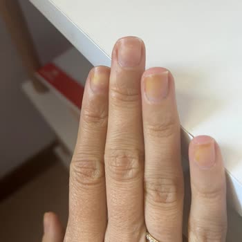 Flormar Oje Tırnaklarımı Sararttı, Bir Daha Asla Almam!