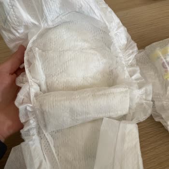 Prima Premium Care Bezde Yoğun Parfüm Kokusu Ve Pişik Sorunu Yaşadık