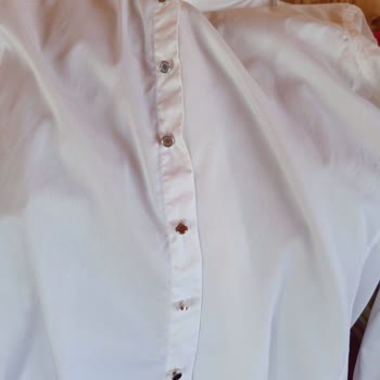 Pierre Cardin Gömlek Düğmeleri Yıkamada Renk Attı, Çözüm Bekliyorum