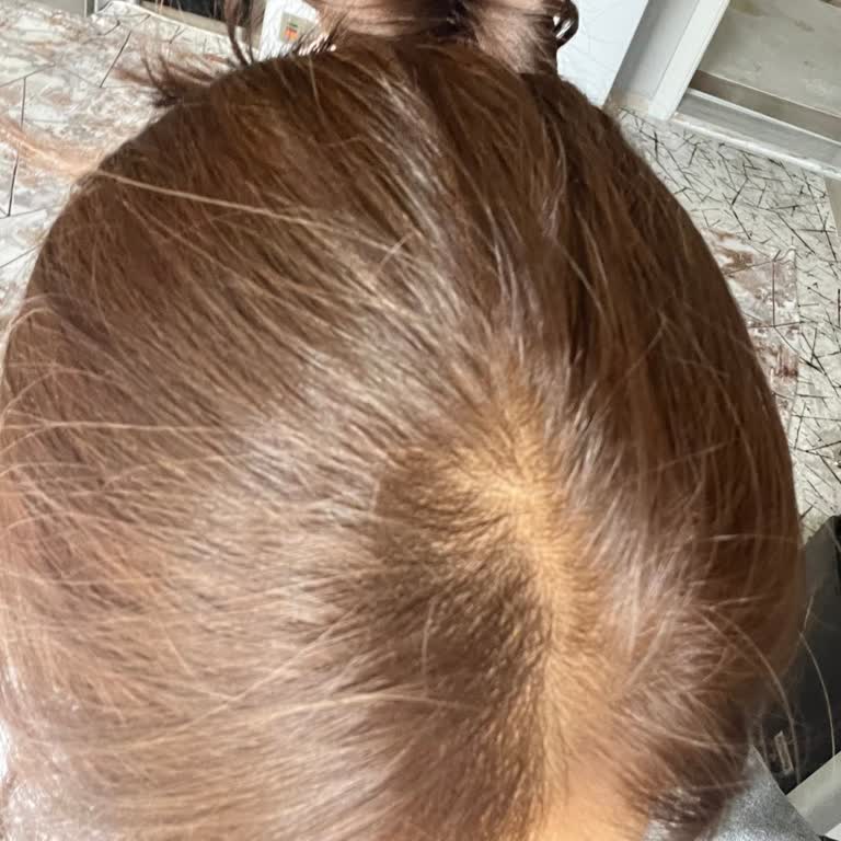 Saç Boyası Renk Sonucu Hayal Kırıklığına Uğrattı