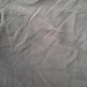 Mavi Gömlekte İlk Yıkamada Beyaz Çizgi Sorunu Ve İade Reddi