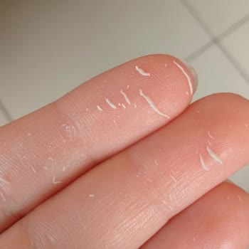 Watsons Beş Yıl Önce Üretilmiş Güneş Kremini Sattı Yüzüm Zarar Gördü