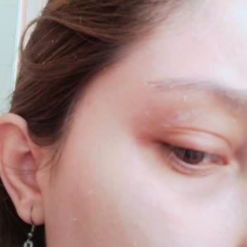 Watsons Beş Yıl Önce Üretilmiş Güneş Kremini Sattı Yüzüm Zarar Gördü