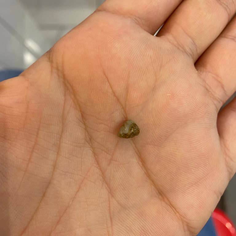 Dürümle Dürümden Taş Çıkması Ve Kötü Deneyim!