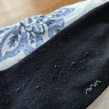 Arçelik Çamaşır Makinesi Kıyafetlerimi Mahvetti, Servis Sorunu Çözmüyor!