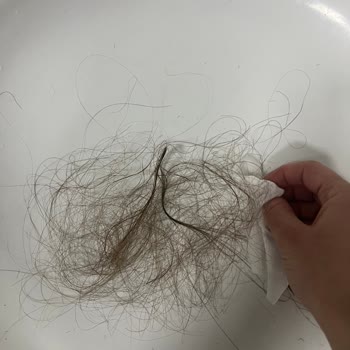 Kaynak Saç İşlemi Sonrası Dökülme Ve Renk Sorunu Yaşadım