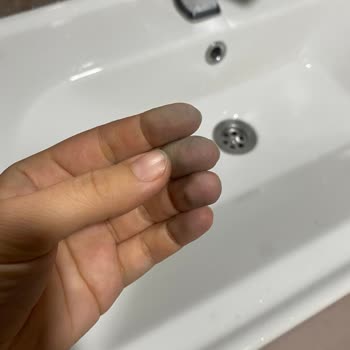 Klozette Renk Akması Ve Temizlik Sorunu Yaşadım