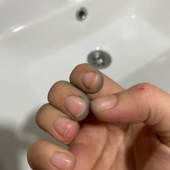 Klozette Renk Akması Ve Temizlik Sorunu Yaşadım