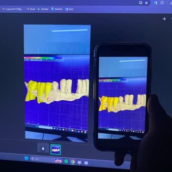Asus Monitörümdeki Renk Solması Sorununa Çözüm Bulunmuyor