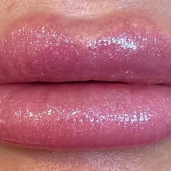 Dalisda Cosmotology Ankara'da Yanlış İşlem Yapıldı