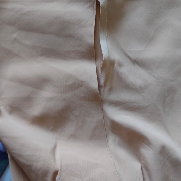 Doğum Sonrası Alınan Korse İlk Giyişte Açıldı İade Süreci Mağdur Ediyor