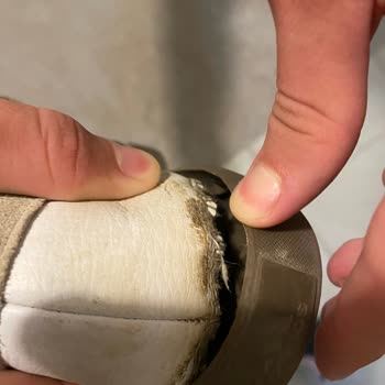 Adidas Spor Ayakkabının Arka Tabanı Kısa Sürede Çıktı, Mağduriyetimiz Giderilmiyor