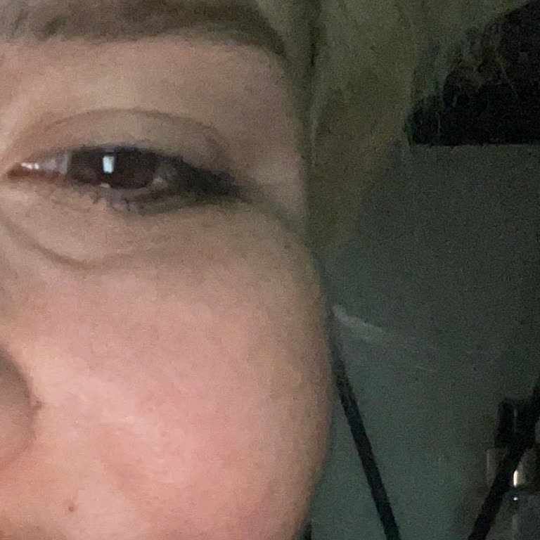 Estetikte Hüsran: Liva Klinik'te Yaşadığım Deformasyon Ve İlgisizlik