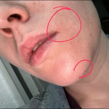 Dermoskin Ürünleri Yüzümde Yanma Ve Hassasiyete Yol Açtı