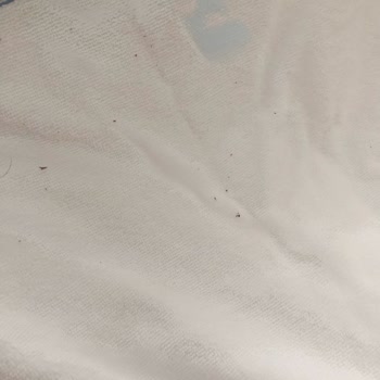 Sipariş Verdiğim Havlular Kirli Ve Kalitesiz Geldi