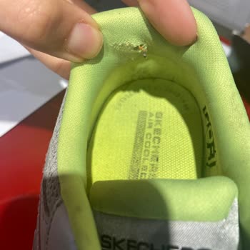 SuperStep'ten Alınan Skechers Ayakkabının Kusuru Ve Tüketici Hakları'ndan Dönüş Alınamaması