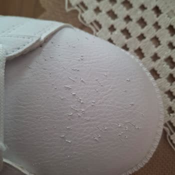 Kısa Sürede Soyulan Ayakkabı Ve İade Sürecinde Destek Eksikliği