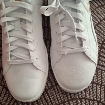 Kısa Sürede Soyulan Ayakkabı Ve İade Sürecinde Destek Eksikliği