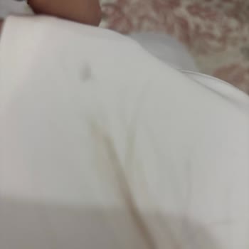 Geç Teslimat Ve Lekeli Ürün Nedeniyle Mağduriyet