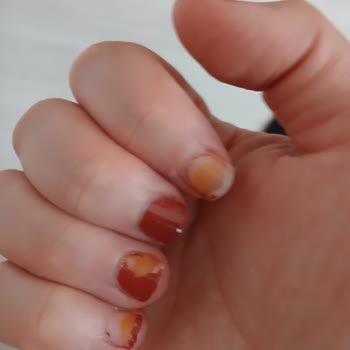 Flormar Ojesi Tırnaklarımda Kalıcı Leke Bıraktı, Müşteri Hizmeti Yanıt Vermiyor