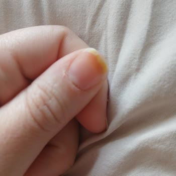 Flormar Ojesi Tırnaklarımda Kalıcı Leke Bıraktı, Müşteri Hizmeti Yanıt Vermiyor