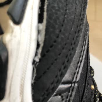 Kısa Sürede Açılan Skechers Ayakkabıya Kullanıcı Hatası Denilmesi Güvenimi Sarsıyor