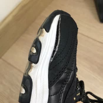 Kısa Sürede Açılan Skechers Ayakkabıya Kullanıcı Hatası Denilmesi Güvenimi Sarsıyor