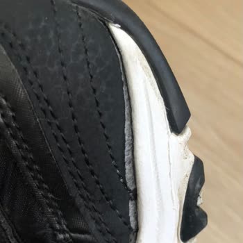 Kısa Sürede Açılan Skechers Ayakkabıya Kullanıcı Hatası Denilmesi Güvenimi Sarsıyor