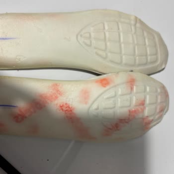 Farklı İç Taban Ve Keçe Nedeniyle Ayağımda Ağrıya Sebep Olan Ayakkabı