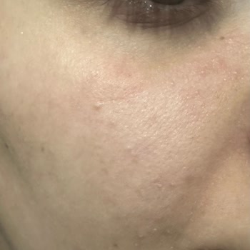 Riche Creme Krem Yüzümde Ciddi Tahrişe Sebep Oldu, İade Talebim Karşılanmıyor