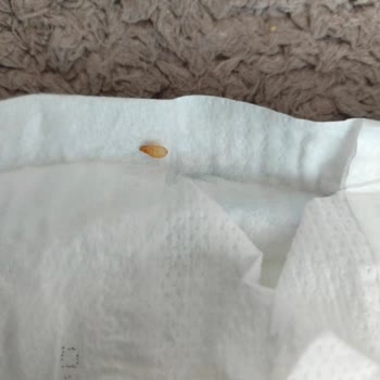 Molfix 6 Numara Bebek Bezinde Beklenmedik Üretim Hatasıyla Karşılaştım