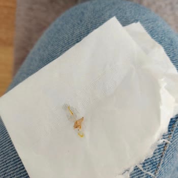 Molfix 6 Numara Bebek Bezinde Beklenmedik Üretim Hatasıyla Karşılaştım