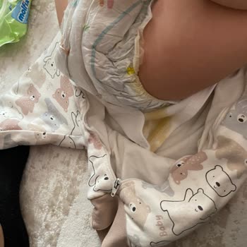 Prima Bebek Bezinde Sürekli Taşırma Ve Kalite Düşüşü Mağduriyeti