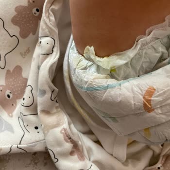Prima Bebek Bezinde Sürekli Taşırma Ve Kalite Düşüşü Mağduriyeti