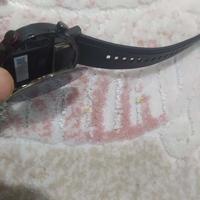 Honor Magic Watch 2 Akıllı Saatte Servis Süreci Ve Müşteri Memnuniyetsizliği