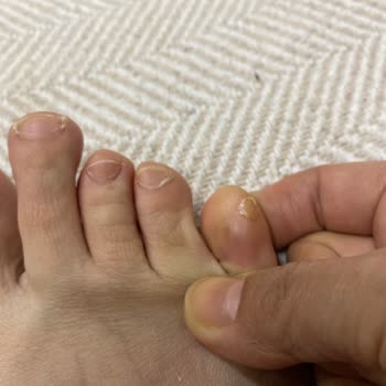 Intersport Aldığım Ayakkabı Sağlığımı Olumsuz Etkiledi, Mağaza İlgisiz Kaldı