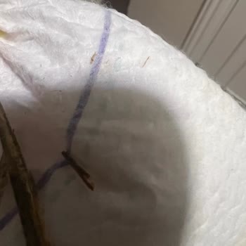 Prima Bebek Bezinde Odun Parçası Çıkması Ve Güven Kaybı