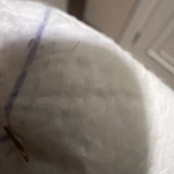 Prima Bebek Bezinde Odun Parçası Çıkması Ve Güven Kaybı