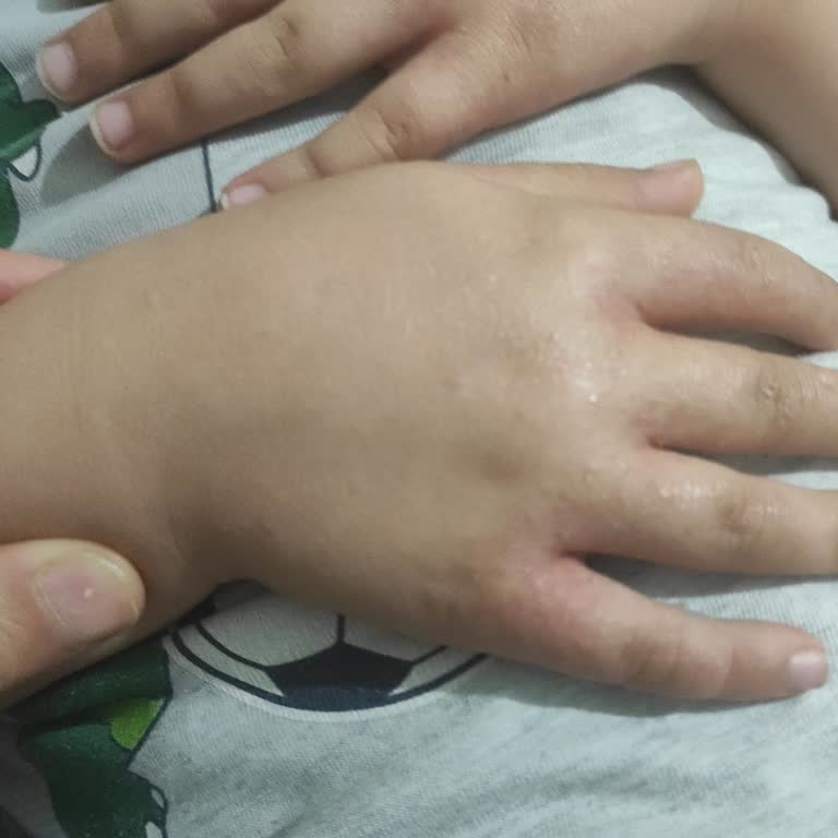 Uyuz Hastalığı İçin İstanbul'da Cildiye Randevusu Bulamıyorum