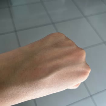 Shell Üçkuyular İstasyonunda Sabunlara Çamaşır Suyu Konulması Nedeniyle Cilt Sorunu Yaşadım