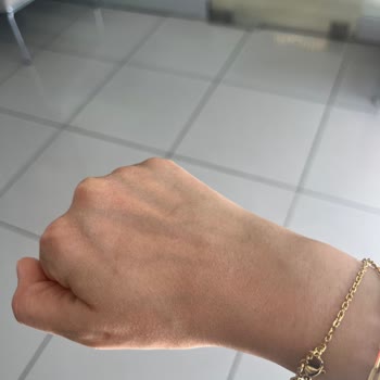 Shell Üçkuyular İstasyonunda Sabunlara Çamaşır Suyu Konulması Nedeniyle Cilt Sorunu Yaşadım