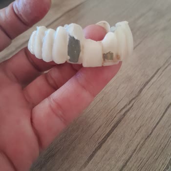 Diş Tedavisi Sonrası Yaşadığım Mağduriyet Ve İlgisizlik