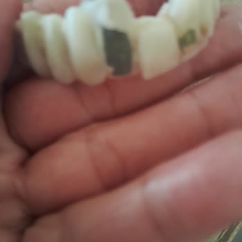 Diş Tedavisi Sonrası Yaşadığım Mağduriyet Ve İlgisizlik