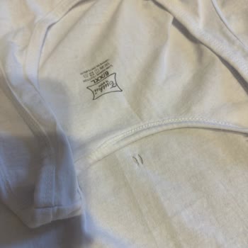 Trendyol'dan Satın Alınan Kalitesiz Ve Hasarlı Ürün İçin Çözüm Sunulmuyor