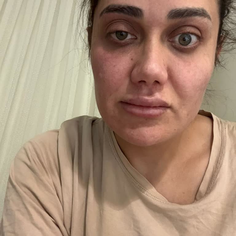 Uz. Dr. Güner Koyuncu Yaptırdığım İşlemler Sonrası Mağdur Oldum