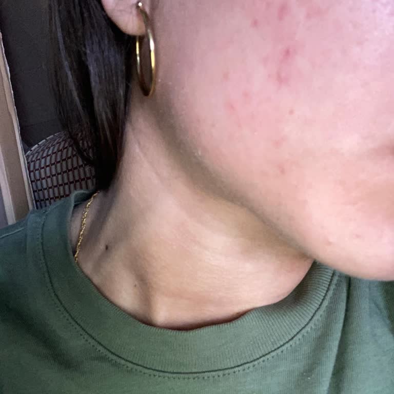 I’ve Used Yves Rocher Sunscreen for Years But the New Formula Now Peels Off My Skin